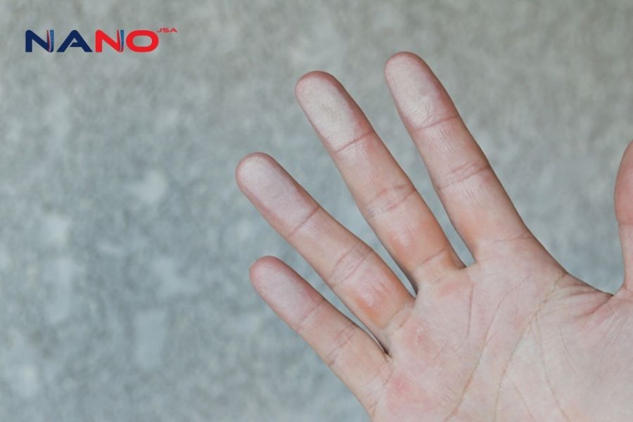 Cách Khắc Phục Hiện Tượng Phấn Hóa Ở Bề Mặt Tường